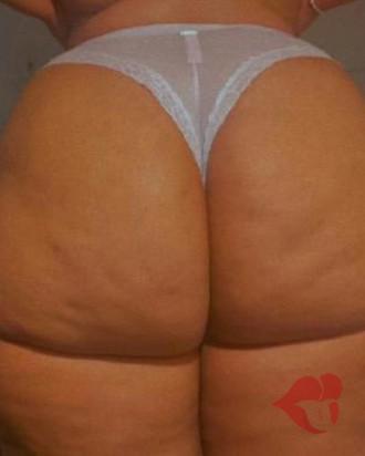 Photo 36062
